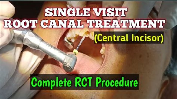 Where do I file RCT-101?